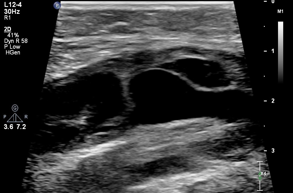 Marcos A. P. Borges, MD 🇧🇷 tweet media