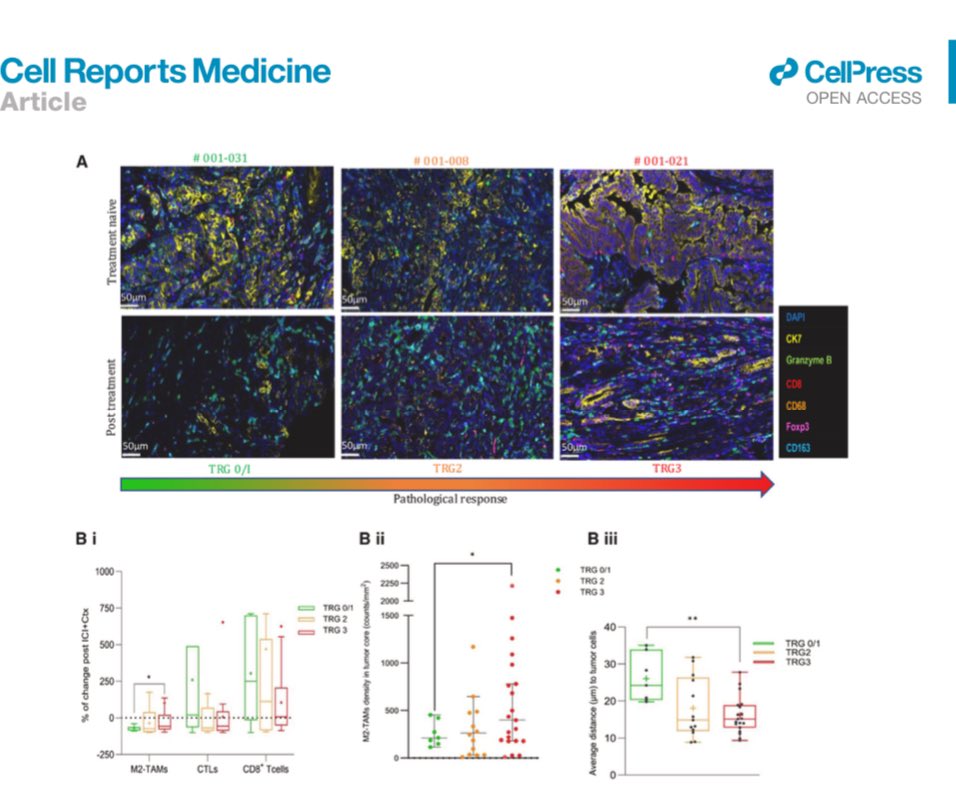 Traditional biomarkers (PDL1 CPS/TPS, MMR) of response to ICI not very informative in this phase 2 trial - but integrating scRNAseq data with multiplex imaging identified M2 Macrophage density and proximity to cancer cells predictive of poor response. A target for future studies