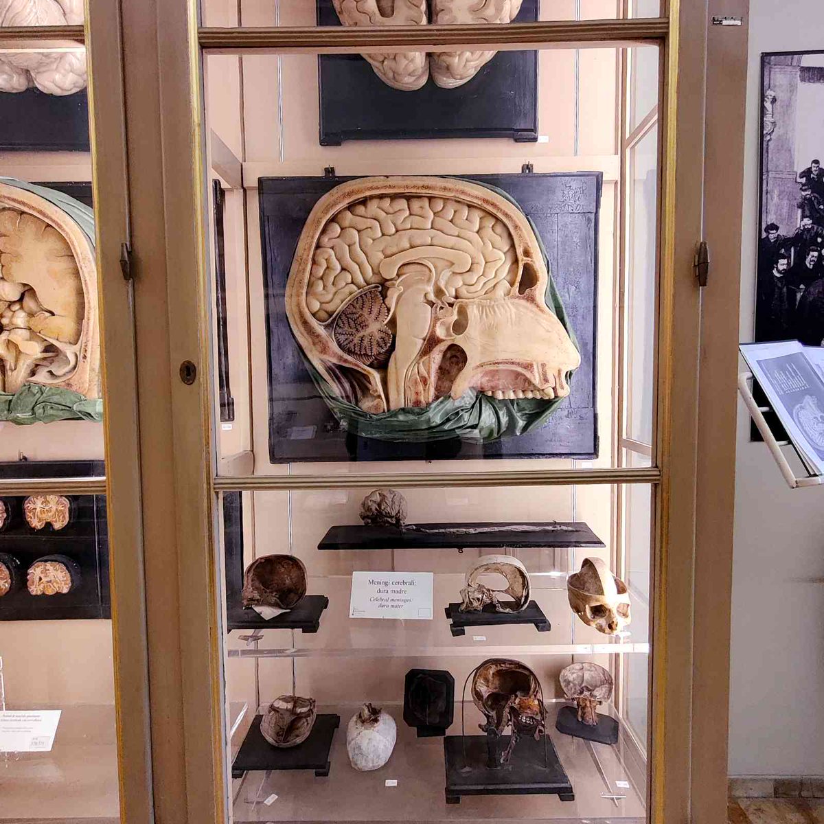 🏛️ Fascinante visita a la Colección de modelos de cera anatómica "Luigi Cattaneo" en Bolonia. Un legado artístico-científico del s. XVIII que revolucionó el estudio del cuerpo humano.
#sciart 
isaloureiro.com/2025/04/14/vis…