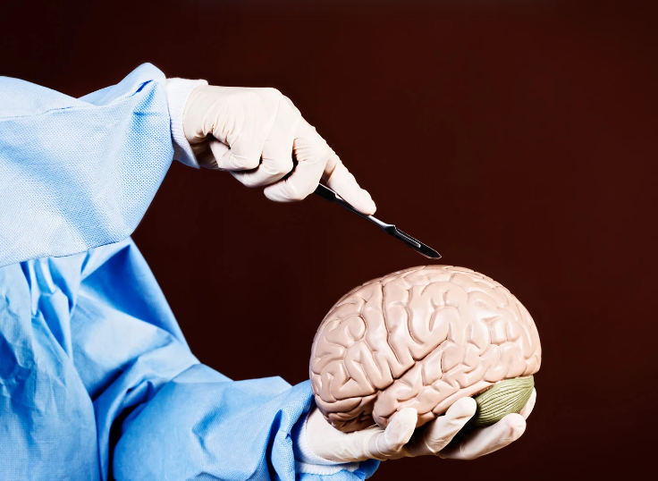 Trauma Surgery & Acute Care Open (TSACO) (@tsaco_aast) on Twitter photo The 2025 Mattox Meeting continues #TCCACS2025
Decompressive craniectomy for traumatic brain injury: a review of recent landmark trials
➡️ bit.ly/42LriRh
Treatment must be tailored and focus on functional outcomes and patient-centered recovery goals
<a href="/TCCACS/">Mattox/Vegas TCCACS</a> The 2025 Mattox Meeting continues #TCCACS2025
Decompressive craniectomy for traumatic brain injury: a review of recent landmark trials
➡️ bit.ly/42LriRh
Treatment must be tailored and focus on functional outcomes and patient-centered recovery goals
<a href="/TCCACS/">Mattox/Vegas TCCACS</a>