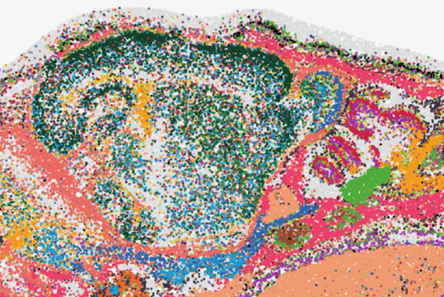 Science in Boston (@scienceinboston) on Twitter photo 🔬 A new computational approach pioneered by researchers at the <a href="/broadinstitute/">Broad Institute</a> eliminates time-intensive imaging, enabling high-resolution spatial mapping of gene expression in tissue.
See how they're making #SpatialTranscriptomics easier for everyone: bit.ly/3G9Hrau 🔬 A new computational approach pioneered by researchers at the <a href="/broadinstitute/">Broad Institute</a> eliminates time-intensive imaging, enabling high-resolution spatial mapping of gene expression in tissue.
See how they're making #SpatialTranscriptomics easier for everyone: bit.ly/3G9Hrau