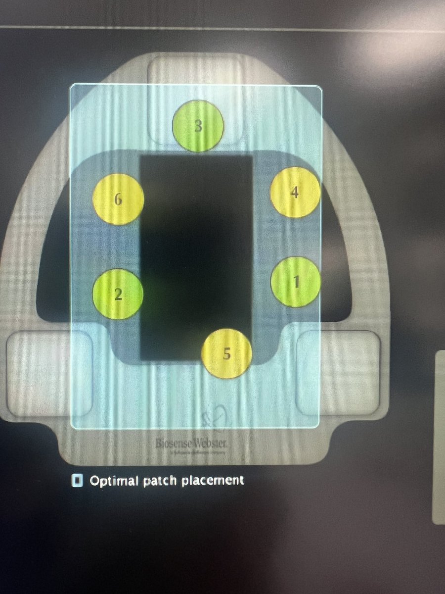 👇EP Nursing meets Art 🖼️👇

👉 When EP nurses truly love what they do, you get something as beautiful as this image 🤩🤩 It’s not just clinical skill, it’s pure passion and precision 🫶🫶

#EPeeps It’s more than just clinical work — it’s a craft. This kind of image belongs in