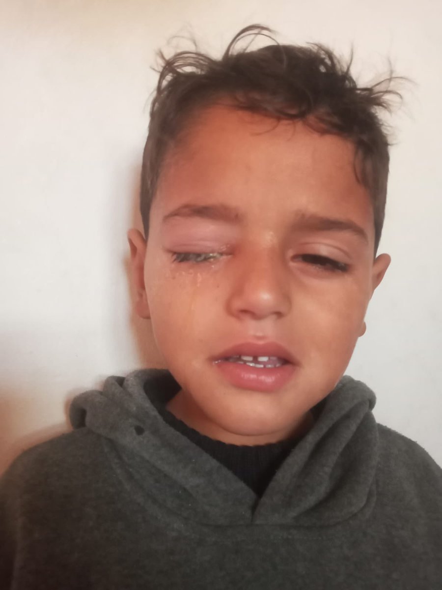 All7m_Mahmou14d's tweet photo. I BEG YOU DONT SKIP !!!
I ask everyone to share this post, So we reach a large number of people who can help!
Share, donate and Reply with 🇵🇸، 🍉
https://t.co/vqkIGTAW3K https://t.co/aL2CVQfEU7