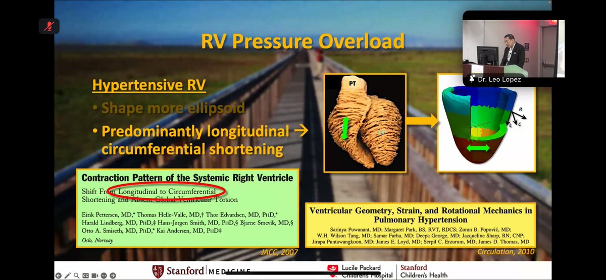 Alina Nicoara (@nicoa002) on Twitter photo Such a priviledge to have Dr. Leo Lopez <a href="/stanfordpedcard/">Stanford Pediatric Cardiology</a> give the Page Anderson Grand Rounds at Duke Pediatric Cardiology <a href="/DukePCRFellow/">Duke Pediatric Cardiology Fellowship</a>. <a href="/DukeHeartCenter/">Duke Heart</a> <a href="/IACaccred/">IAC | Intersocietal Accreditation Commission</a> <a href="/MerriBremer/">Merri Bremer</a> <a href="/kokopark13/">Margaret M Park</a> <a href="/katie_gibson311/">Katie Gibson</a> <a href="/ASE360/">American Society of Echocardiography</a> <a href="/DavidWienerMD/">David H. Wiener, MD</a> Such a priviledge to have Dr. Leo Lopez <a href="/stanfordpedcard/">Stanford Pediatric Cardiology</a> give the Page Anderson Grand Rounds at Duke Pediatric Cardiology <a href="/DukePCRFellow/">Duke Pediatric Cardiology Fellowship</a>. <a href="/DukeHeartCenter/">Duke Heart</a> <a href="/IACaccred/">IAC | Intersocietal Accreditation Commission</a> <a href="/MerriBremer/">Merri Bremer</a> <a href="/kokopark13/">Margaret M Park</a> <a href="/katie_gibson311/">Katie Gibson</a> <a href="/ASE360/">American Society of Echocardiography</a> <a href="/DavidWienerMD/">David H. Wiener, MD</a>