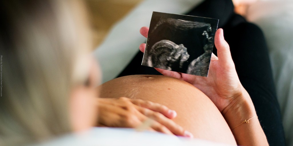Tax Notes (@taxnotes) on Twitter photo A Kansas bill creating an income tax exemption for parents of unborn children has become law after the Legislature overrode Democratic <a href="/GovLauraKelly/">Governor Laura Kelly</a>'s veto.
Read more from <a href="/EmilyHoll9/">Emily Hollingsworth</a>: taxnotes.co/43TFyZm A Kansas bill creating an income tax exemption for parents of unborn children has become law after the Legislature overrode Democratic <a href="/GovLauraKelly/">Governor Laura Kelly</a>'s veto.
Read more from <a href="/EmilyHoll9/">Emily Hollingsworth</a>: taxnotes.co/43TFyZm