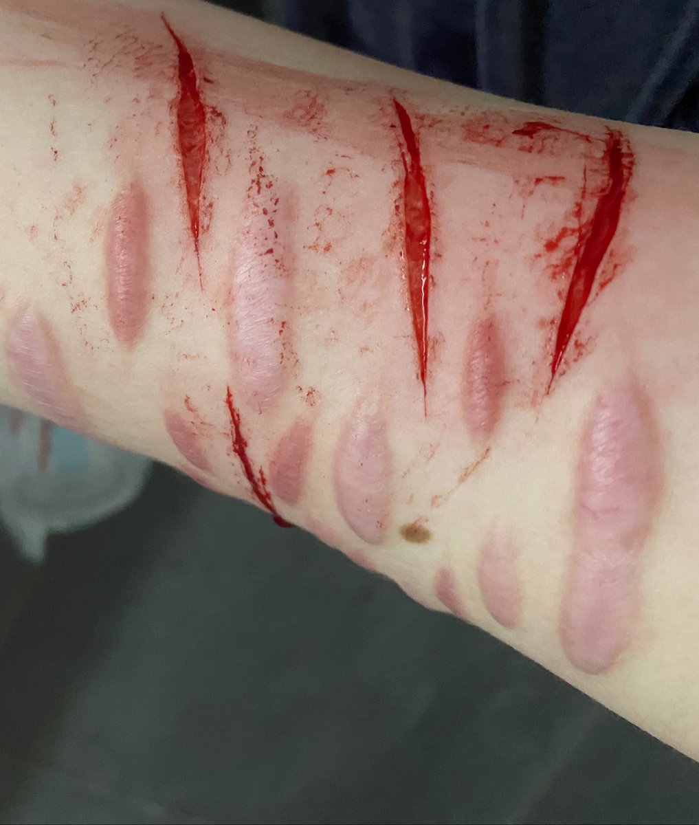 Guess what loser relapsed🔥🔥🤣🤣