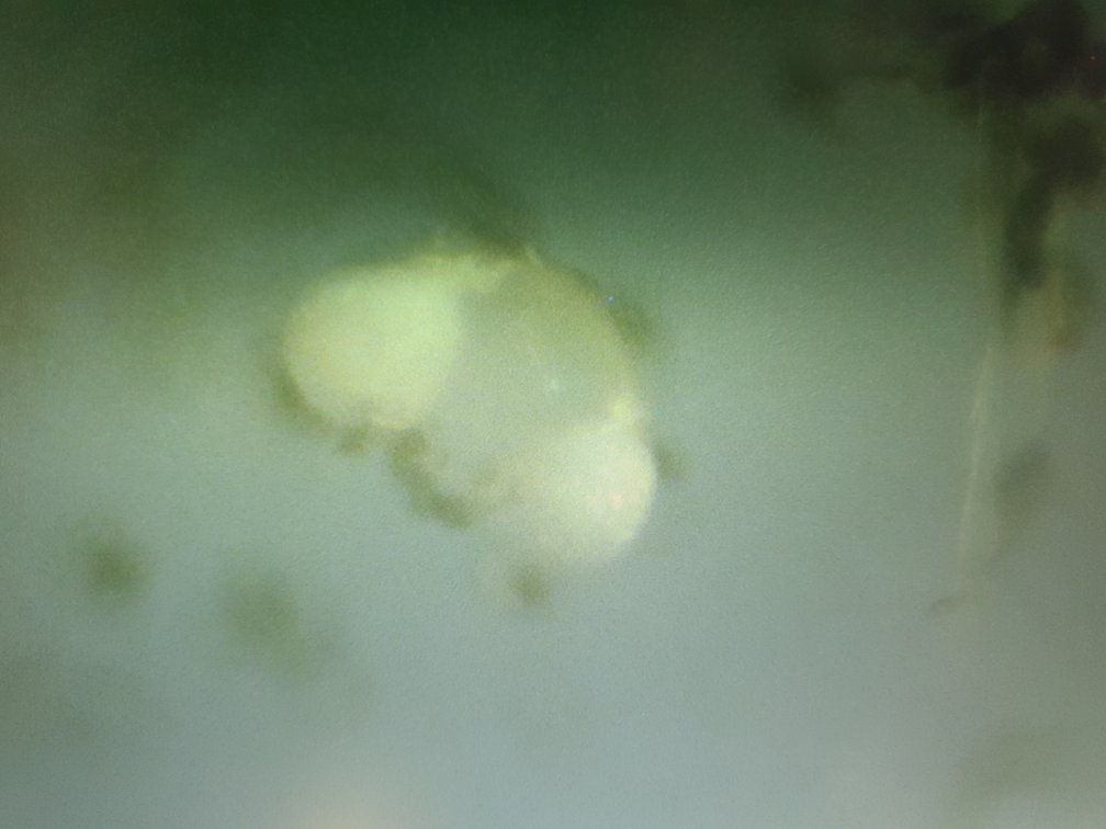 HealthRanger's tweet image. Remember those "diploid masses" that looked like small eggs, found in the weird fog / chemtrails fallout sample from Dr. Jane Ruby? Well, I've been incubating the sample for about a week at human body temperature, in saline solution to mimic human chemistry. Guess what? THEY'RE…