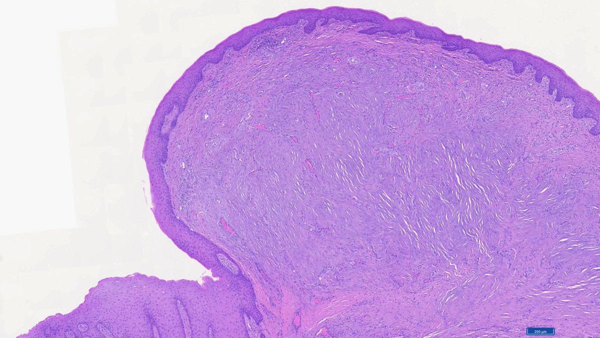 Hashimoto__0's tweet image. Oral cavity, gingiva