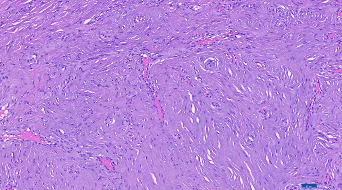 Hashimoto__0's tweet image. Oral cavity, gingiva