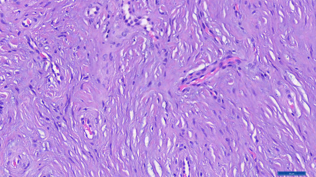 Hashimoto__0's tweet image. Oral cavity, gingiva