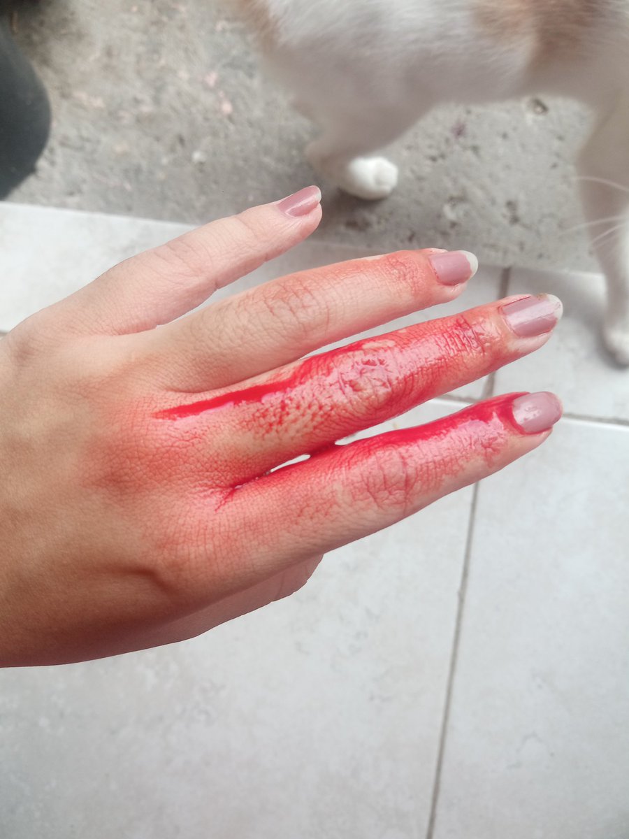 ttometto_32's tweet photo. Pendeja se corta por accidente. https://t.co/mQ1Kc0Eio4
