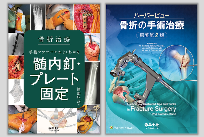 ハーバービュー 骨折の手術治療 原著第2版 ハーバービュー 骨折の手術治療 原著第2版 - 羊土社