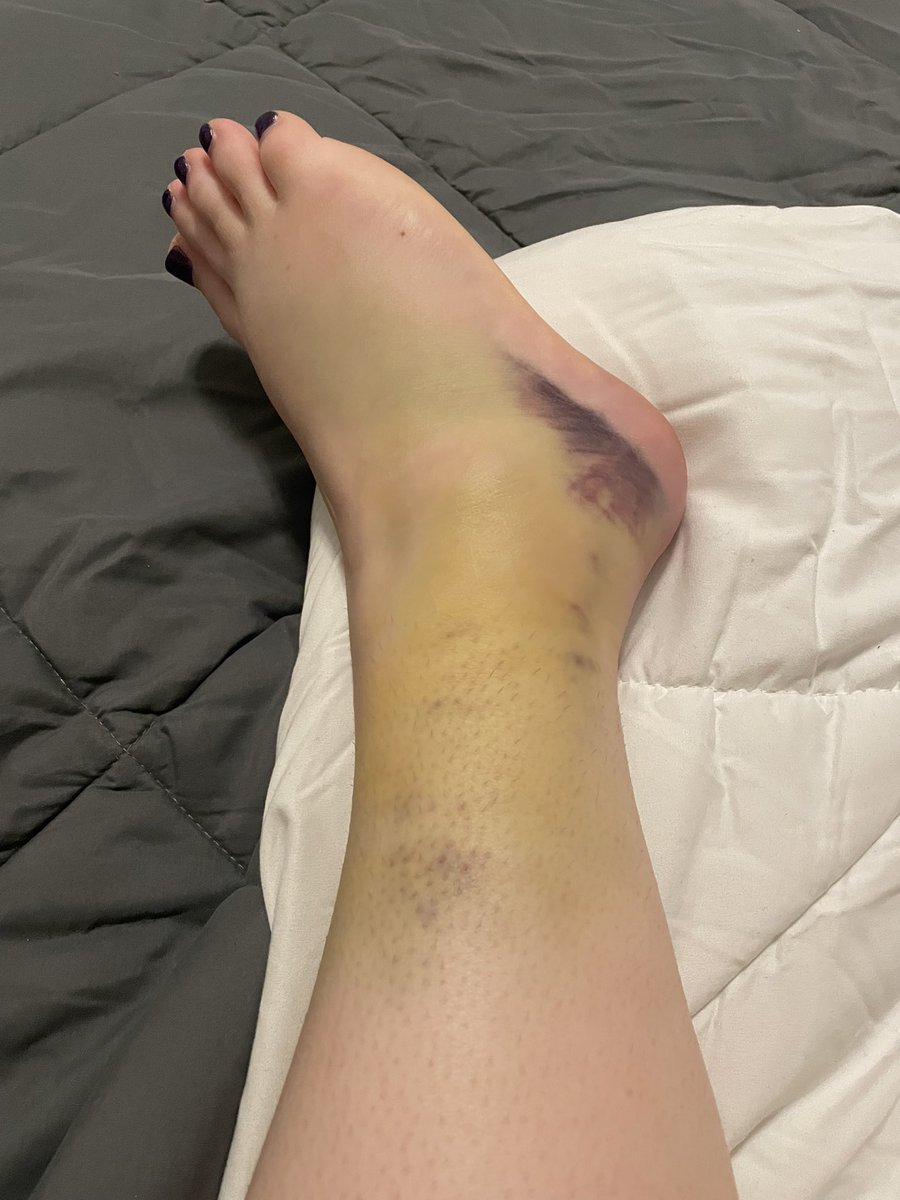 Allison Baker tweet media