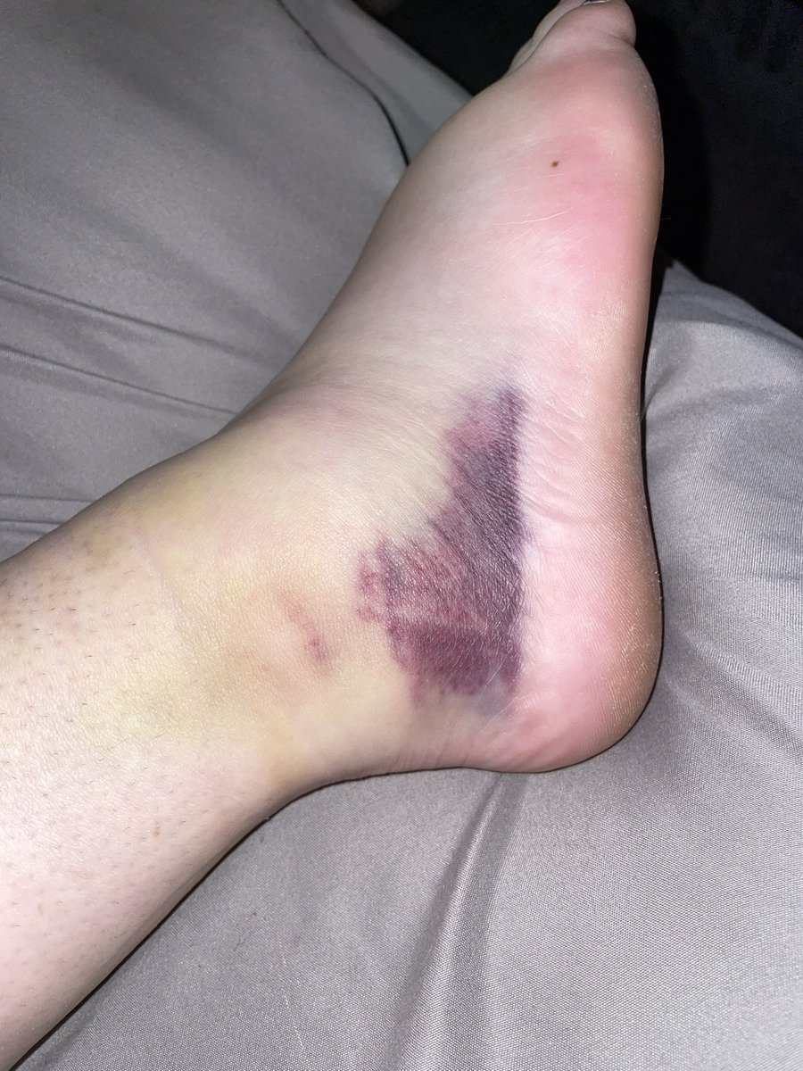 Allison Baker tweet media