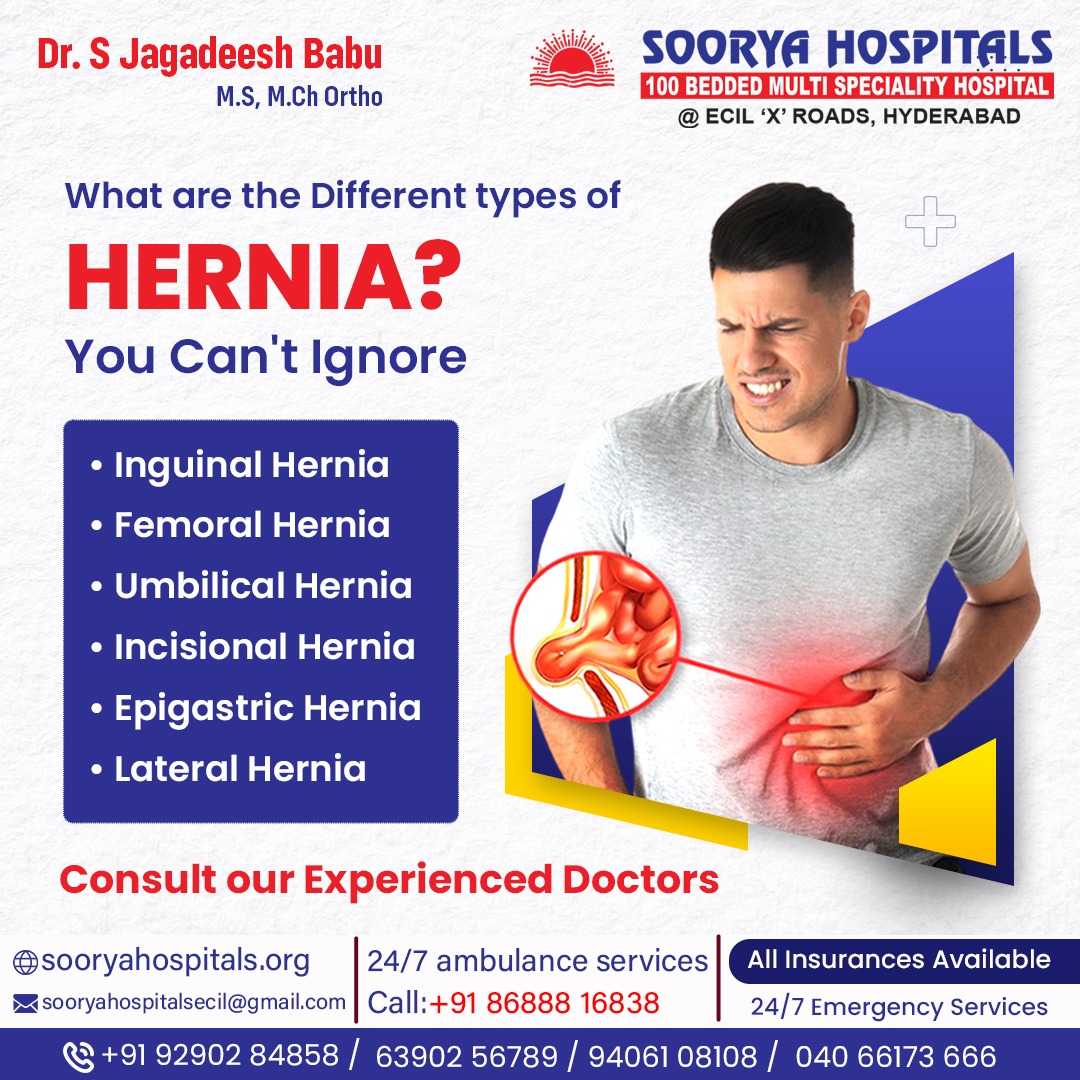 sooryahospitals's tweet photo. 😖 Feeling a bulge or pain in your stomach or groin area? Don’t ignore it – it could be a hernia!
📍 Located in Kushaiguda, Hyderabad,
📞 +91 92902 84858(
#SooryaHospitals #HerniaCare #HyderabadHospitals #HealthAndWellness #multispeclityhosiptal #MultispecialtyCare #HealthFirst https://t.co/ja8LmUAsPm