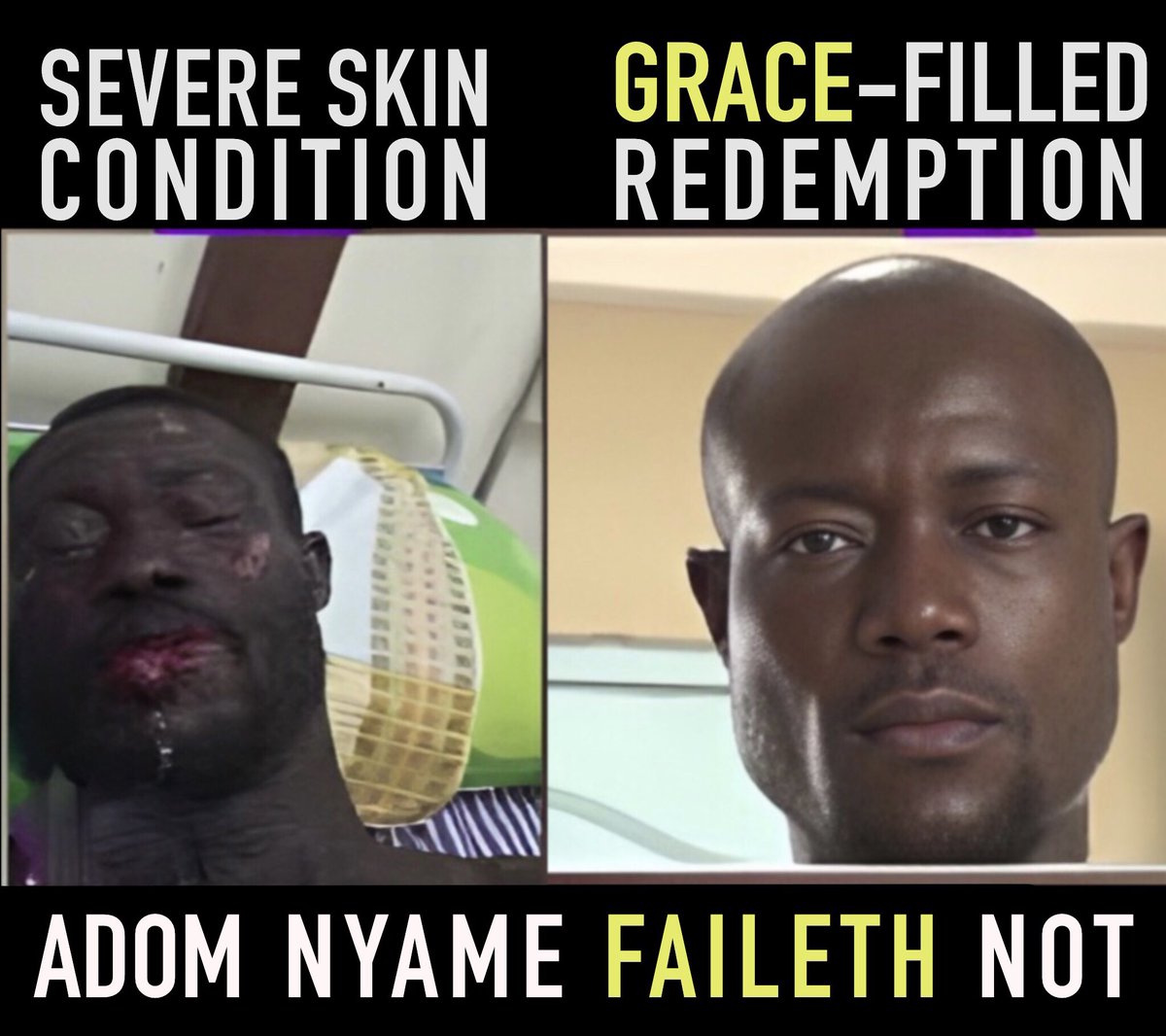 IAmHorlaliGH's tweet photo. So apparently he developed the adverse skin condition after  using the oil given to him by a ‘pastor’ he visited.
#StephenAdomKyeiDuah #GRACEHOUR #GracePrayerMaterials https://t.co/BoN2wy6BWy