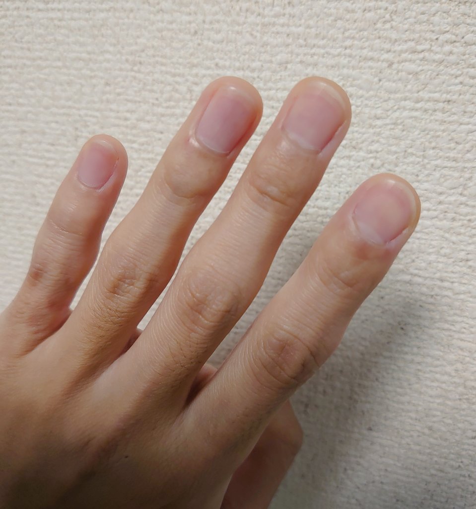 最近ギターを全然弾けていなかったことを爪が物語っている🤚🏻