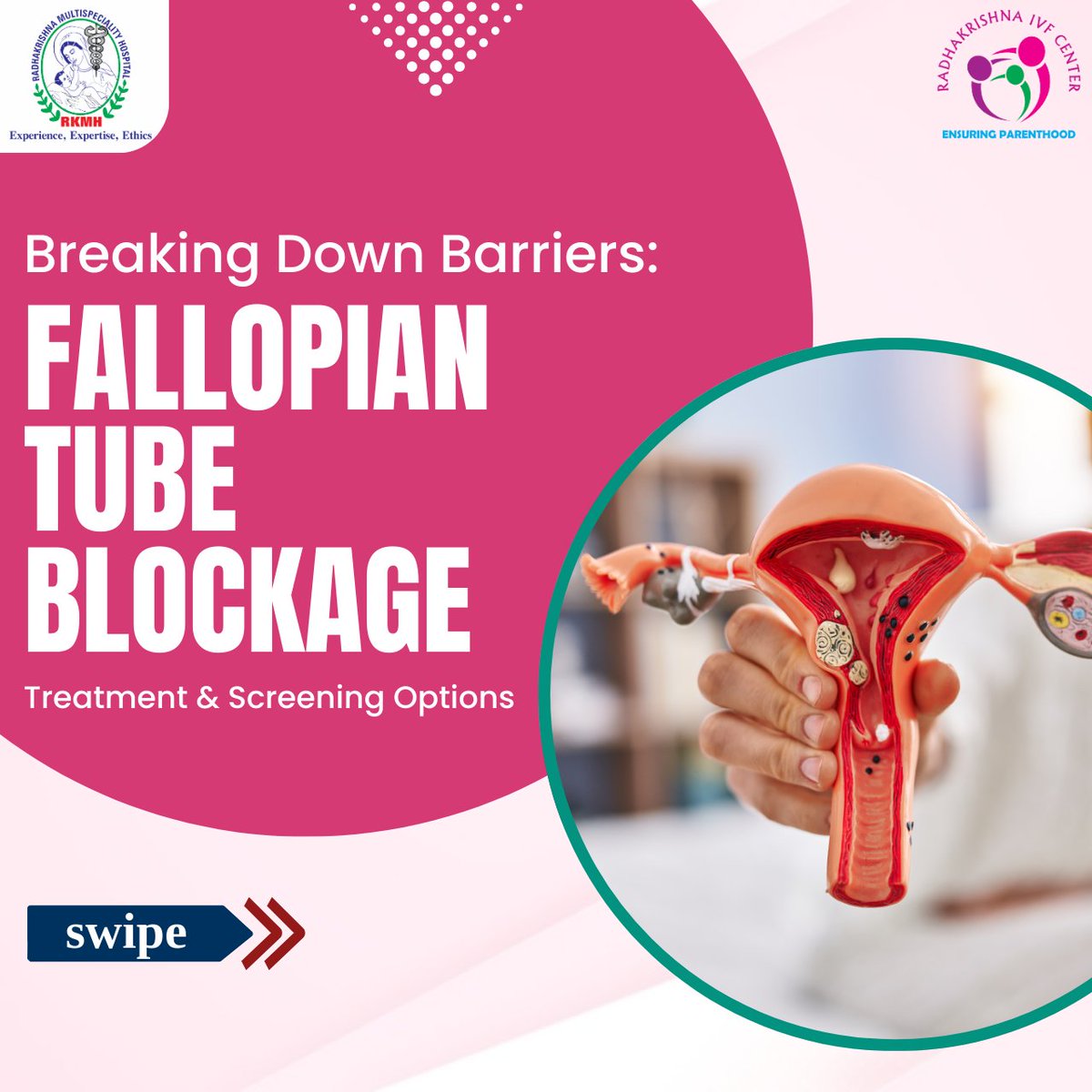radhakrishnaivf's tweet image. Struggling with fallopian tube blockage?

𝐜𝐚𝐥𝐥 𝐮𝐬 𝐨𝐧: 9663160764
.
.
.
#FallopianTubeBlockage #FertilityCare #HSGTest #Laparoscopy #Hysteroscopy #BlockedTubes #IVF #ivftreatment #Fertilitydoctor #ivfhospital #ivfclinic #BengaluruIVF  #DrVidyaVBhat #bengalurunews