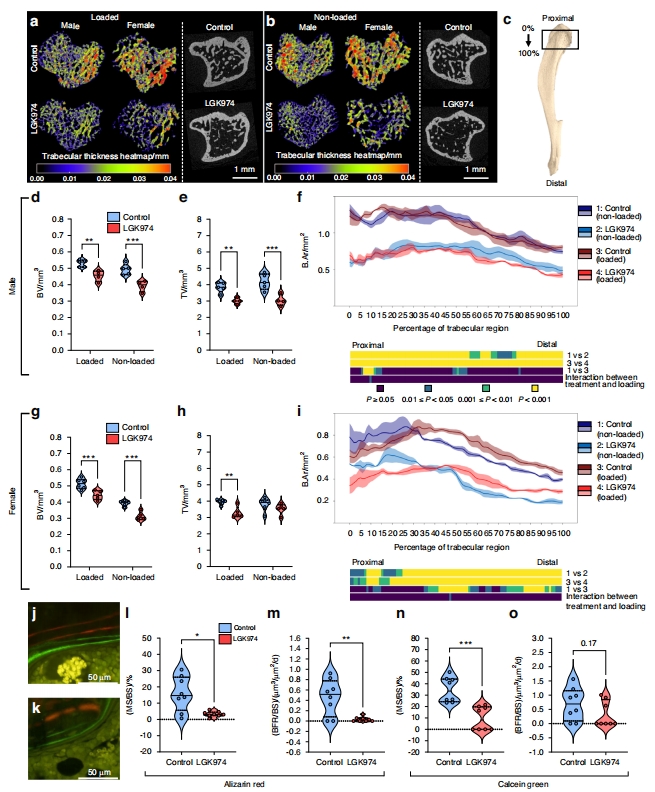 This study was published in Bone Research, the team investigates the impact of LGK974, a Porcupine inhibitor, on bone mass regulation in a sclerosteosis mouse model.
#Bone #Sclerosteosis
Details: doi.org/10.1038/s41413…