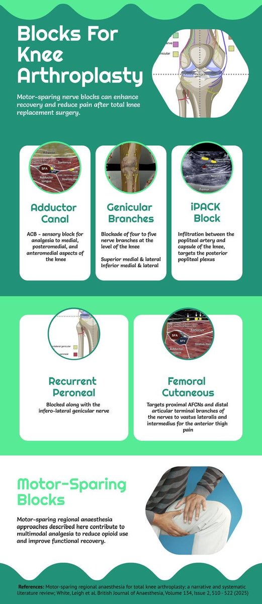 Blocks for Knee Arthroplasty (PD Mawondo)