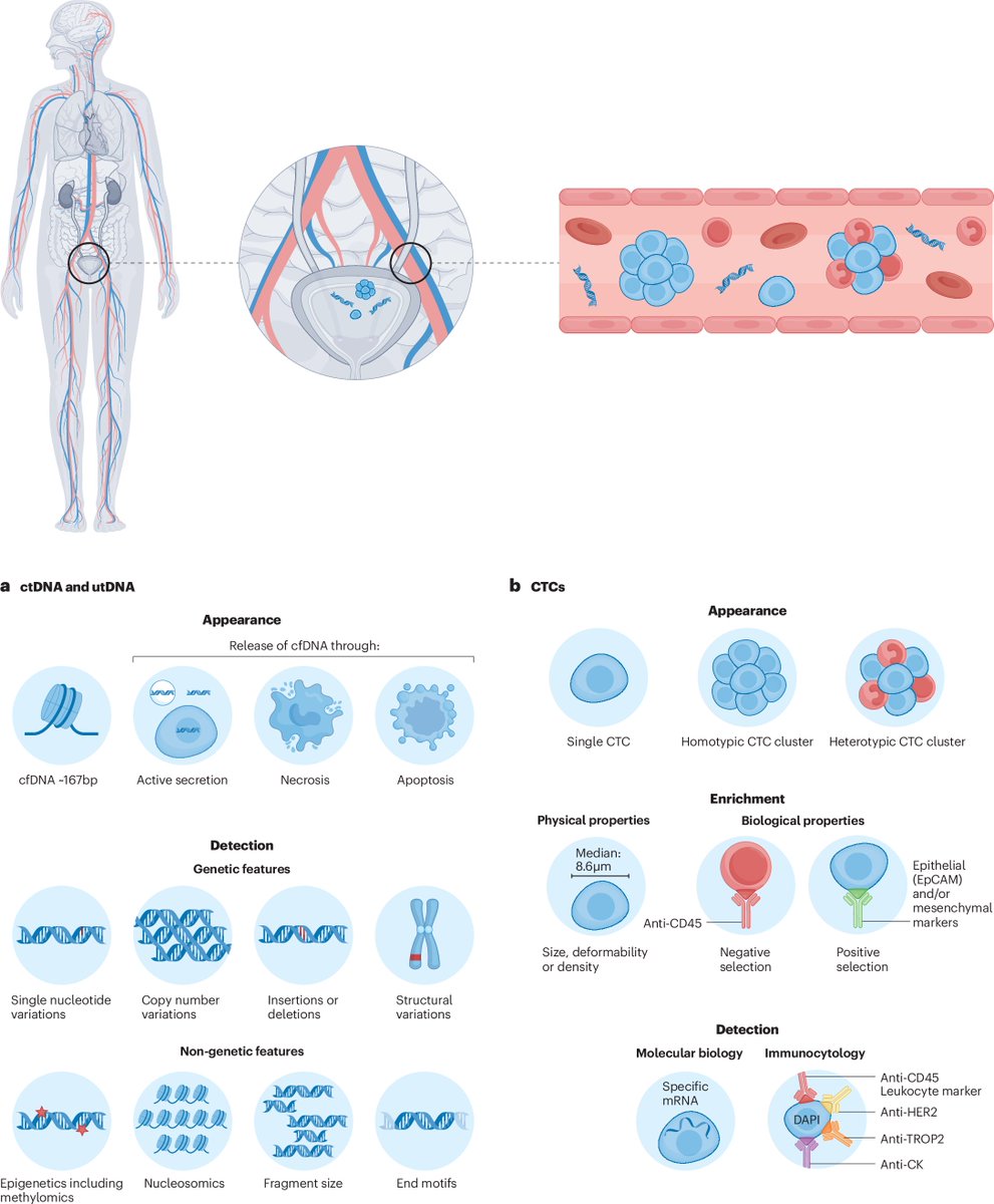 Enrique Grande (@drenriquegrande) on Twitter photo ⚡️ On <a href="/NatRevUrol/">Nature Reviews Urology</a> - ctDNA and CTCs are reshaping bladder cancer care — enabling early detection of minimal residual disease, recurrence prediction, and personalized treatment guidance.
Ongoing trials may soon cement their role in clinical practice.
#BladderCancer ⚡️ On <a href="/NatRevUrol/">Nature Reviews Urology</a> - ctDNA and CTCs are reshaping bladder cancer care — enabling early detection of minimal residual disease, recurrence prediction, and personalized treatment guidance.
Ongoing trials may soon cement their role in clinical practice.
#BladderCancer