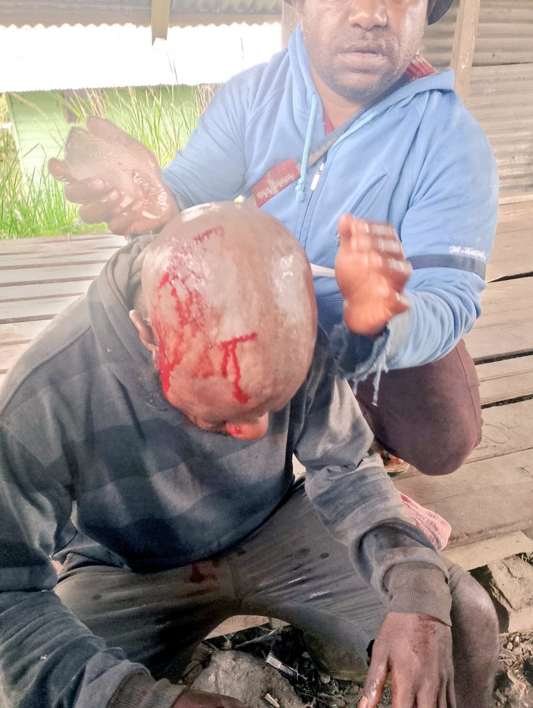 natholiz's tweet photo. Aparat keamanan nkri melakukan tindakan kriminal terhadap warga sipil di Kabupaten Dogiyai. Mohon pantauan semua pihak. 

@NataliusPigai2 
@prabowo 
@YLBHI https://t.co/h2GTlbU75y
