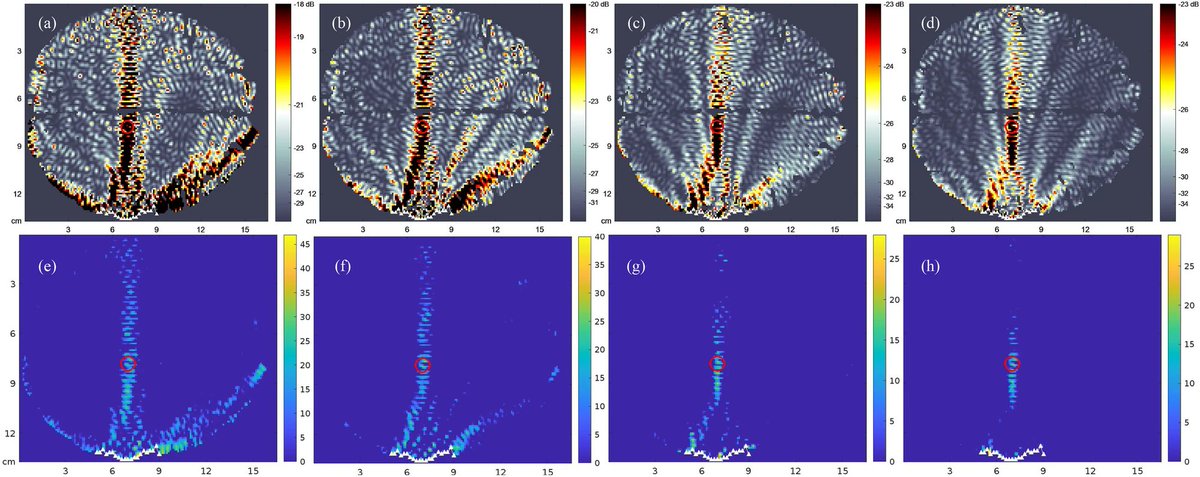 Rice Neuroengineering Initiative (@riceneuro) on Twitter photo Researchers from <a href="/RiceNeuro/">Rice Neuroengineering Initiative</a>, <a href="/RiceECE/">Rice Electrical & Computer Engineering</a>, <a href="/bcm_neurosci/">BCM Department of Neuroscience</a>, and <a href="/MDAndersonNews/">MD Anderson Cancer Center</a> have developed a more reliable model for high-resolution low-intensity neuromodulation in clinical settings with less invasive measurements. Read more in <a href="/SciReports/">Scientific Reports</a> : nature.com/articles/s4159… Researchers from <a href="/RiceNeuro/">Rice Neuroengineering Initiative</a>, <a href="/RiceECE/">Rice Electrical & Computer Engineering</a>, <a href="/bcm_neurosci/">BCM Department of Neuroscience</a>, and <a href="/MDAndersonNews/">MD Anderson Cancer Center</a> have developed a more reliable model for high-resolution low-intensity neuromodulation in clinical settings with less invasive measurements. Read more in <a href="/SciReports/">Scientific Reports</a> : nature.com/articles/s4159…