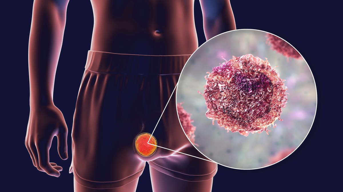 MindBodyIsLife's tweet photo. El 90% de los hombres no tiene idea cuando se trata de la salud testicular.

Pero tu salud testicular lo afecta todo:

• Fertilidad  
• Hormonas  
• Riesgo de cáncer  

Esto es lo que todo hombre necesita saber (y cómo protegerse de forma natural):🧵 https://t.co/ureOXJkgrt