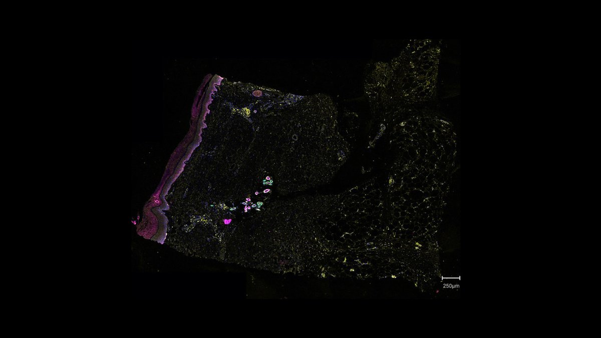 NIH_CommonFund's tweet photo. Want to understand the epidermis at level that's more than just a skin deep? Then come dive into this Cell DIVE image of epidermis, dermis, and hypodermis layers from @_hubmap researchers Dr. Fiona Ginty and Liz McDonough @GEResearch! You can’t fathom this multi-layered approach! https://t.co/c74E8N1GOV