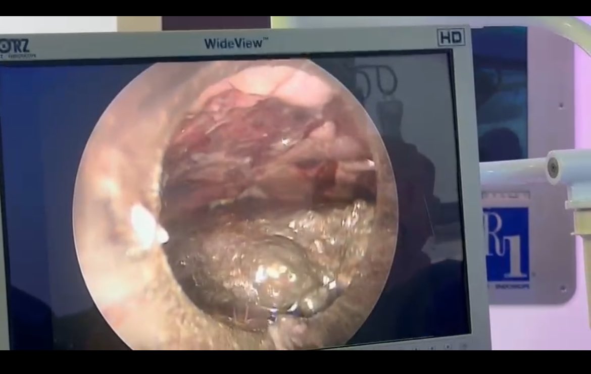 Dr.ALHARTHI Mohammed tweet media