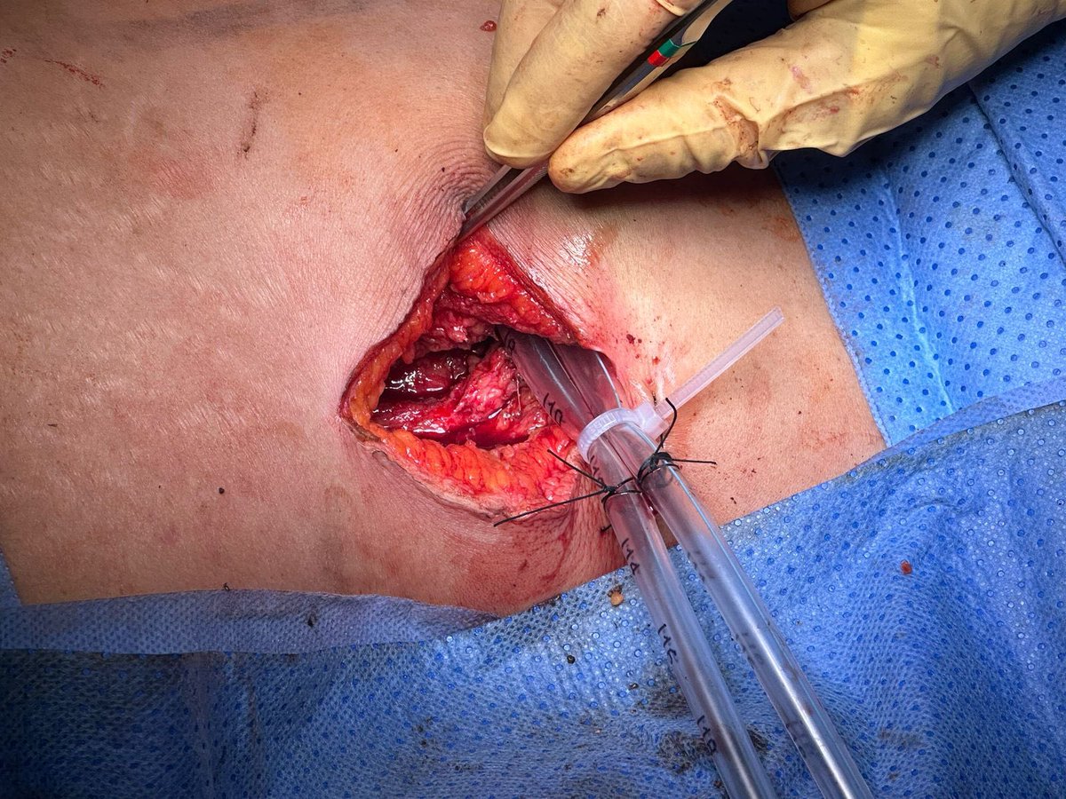 Dr.ALHARTHI Mohammed tweet media