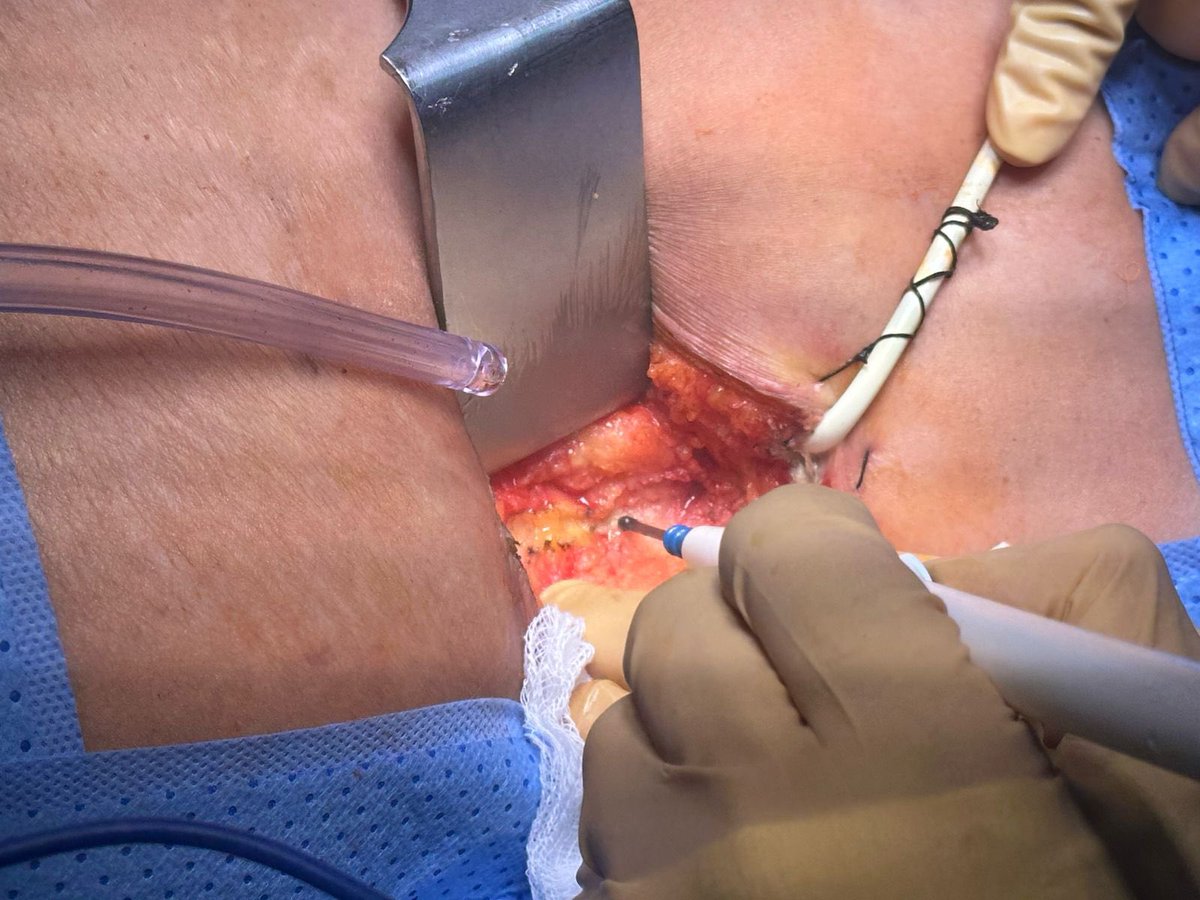 Dr.ALHARTHI Mohammed tweet media