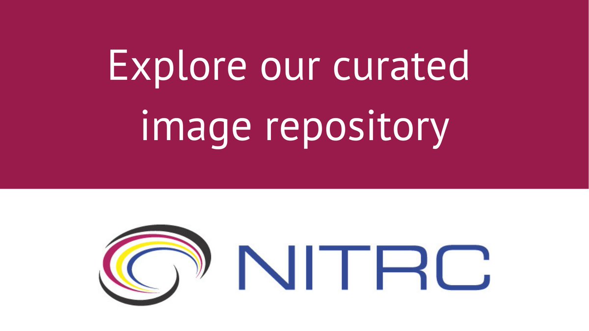 nitrc_info's tweet image. Looking for open neuroimaging datasets? Explore NITRC-IR, our curated image repository featuring data from projects like the 1000 Functional Connectomes, ABIDE, ADHD-200, and more. Search by diagnosis, handedness, and other metadata. #opendata #neuroscience #braindata