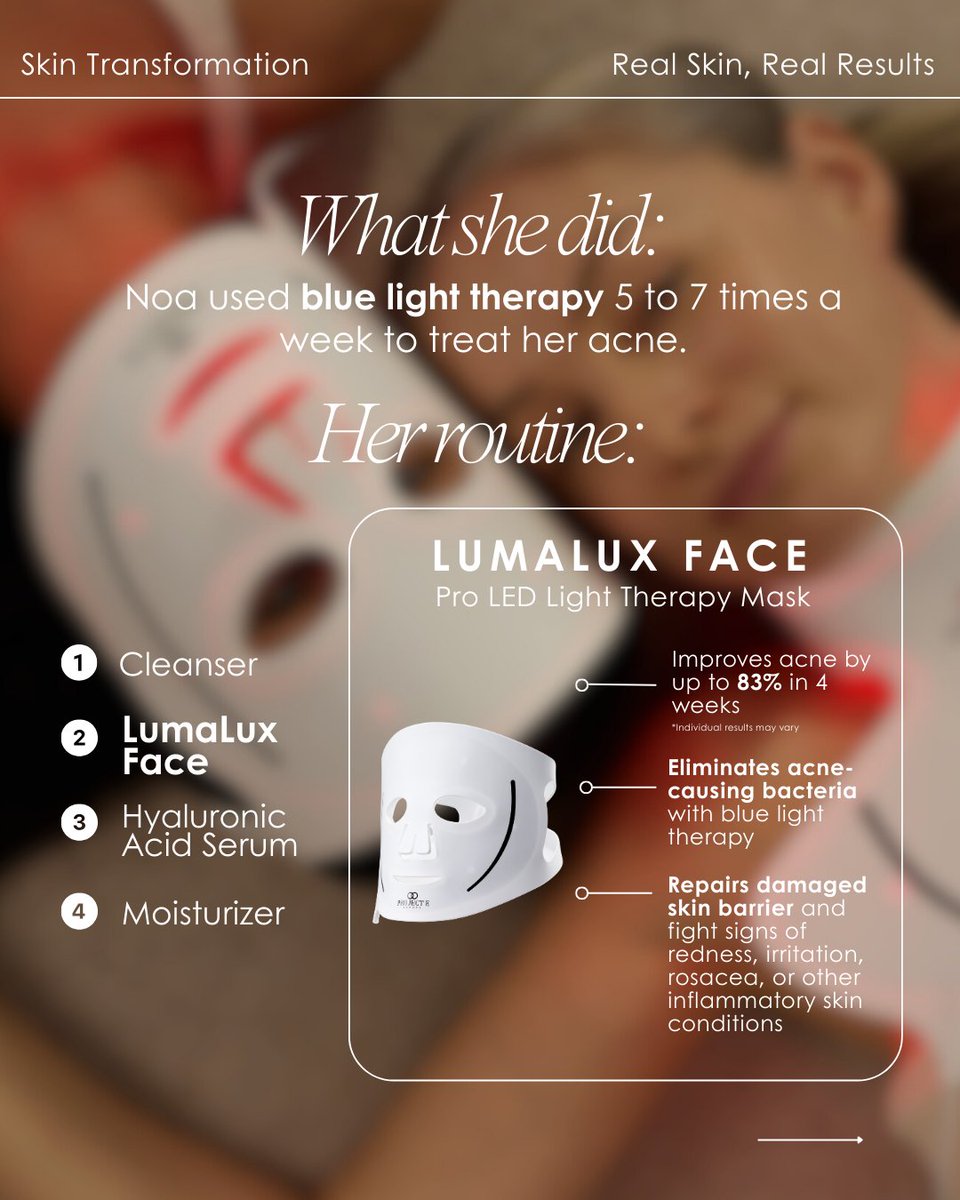 ProjectEBeauty's tweet photo. Noa's inspiring skin transformation has us reaching for our LED masks NOW 💖

Get clearer skin in just 4 weeks with the powerful LumaLux Face designed to clear and heal the skin while reversing signs of skin aging. Get yours for 10% off today with code RESTORE10 at checkout now https://t.co/ek2SFO7VE4