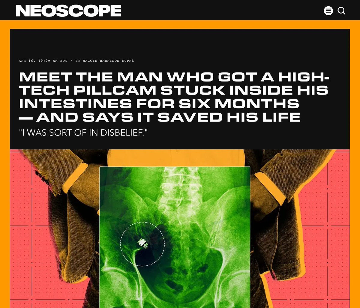 mags_h11's tweet image. NEW: For a decade, a man battled a severe, life-altering GI illness that doctors struggled to diagnose.
Finally, he tried something new: he swallowed a PillCam — which wound up stuck in his intestines for months.
You won't believe what it found.
futurism.com/neoscope/filmm…