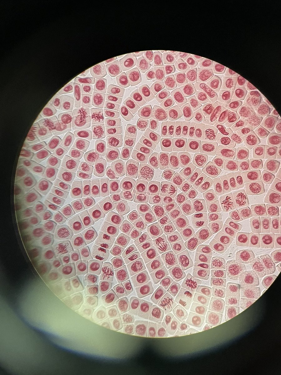 colteent's tweet photo. #practicamitosis #BiologiaGeneralNHyD24_25 #lamejormetafase @VegaGEscudero Cromosomas condensados y alineados en la placa metafásica. https://t.co/qOYgRiIOKL