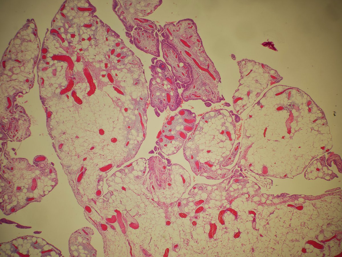 Miruna Popescu, MD tweet media