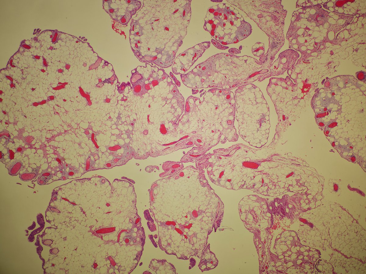 Miruna Popescu, MD tweet media