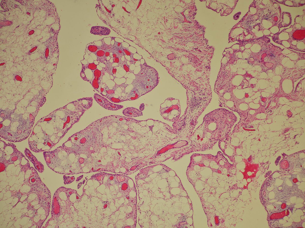 Miruna Popescu, MD tweet media