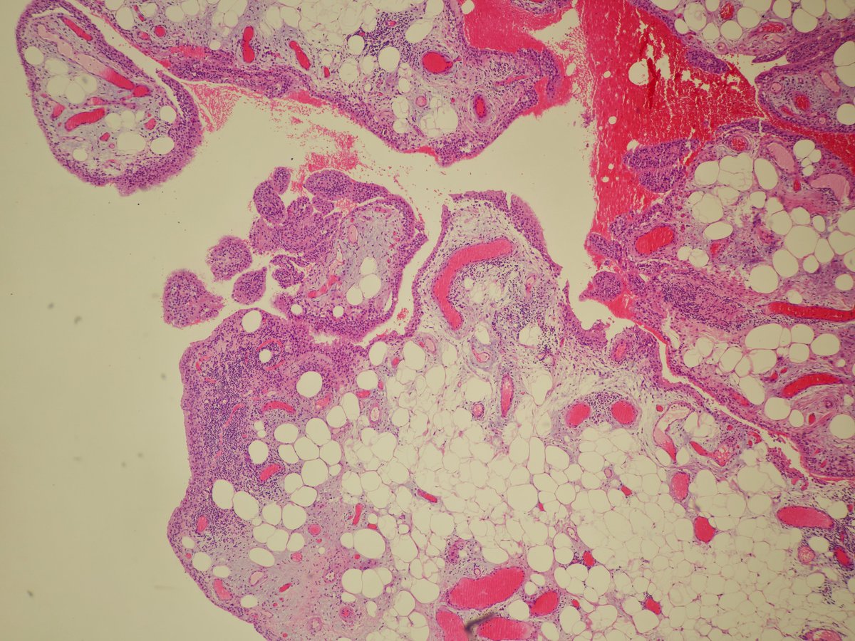 Miruna Popescu, MD tweet media