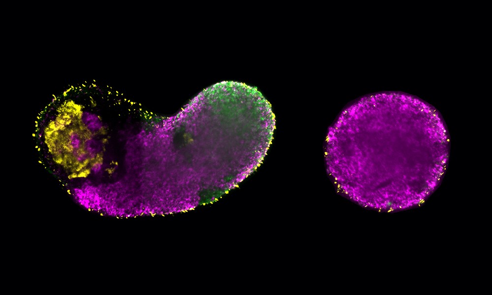 EMBL (@embl) on Twitter photo Metabolism shapes life
<a href="/EMBLBarcelona/">EMBL Barcelona</a> & <a href="/mpicbg/">MPI-CBG Dresden</a> researchers reveal how glycolysis drives early embryonic cell decisions.
The studies, published in <a href="/CellStemCell/">Cell Stem Cell</a>, uncover the instructive potential of glycolysis.
embl.org/news/science/mā¦
<a href="/KStapornwongkul/">Kristina Stapornwongkul</a>
<a href="/viktri08/">Vikas Trivedi</a> Metabolism shapes life
<a href="/EMBLBarcelona/">EMBL Barcelona</a> & <a href="/mpicbg/">MPI-CBG Dresden</a> researchers reveal how glycolysis drives early embryonic cell decisions.
The studies, published in <a href="/CellStemCell/">Cell Stem Cell</a>, uncover the instructive potential of glycolysis.
embl.org/news/science/mā¦
<a href="/KStapornwongkul/">Kristina Stapornwongkul</a>
<a href="/viktri08/">Vikas Trivedi</a>