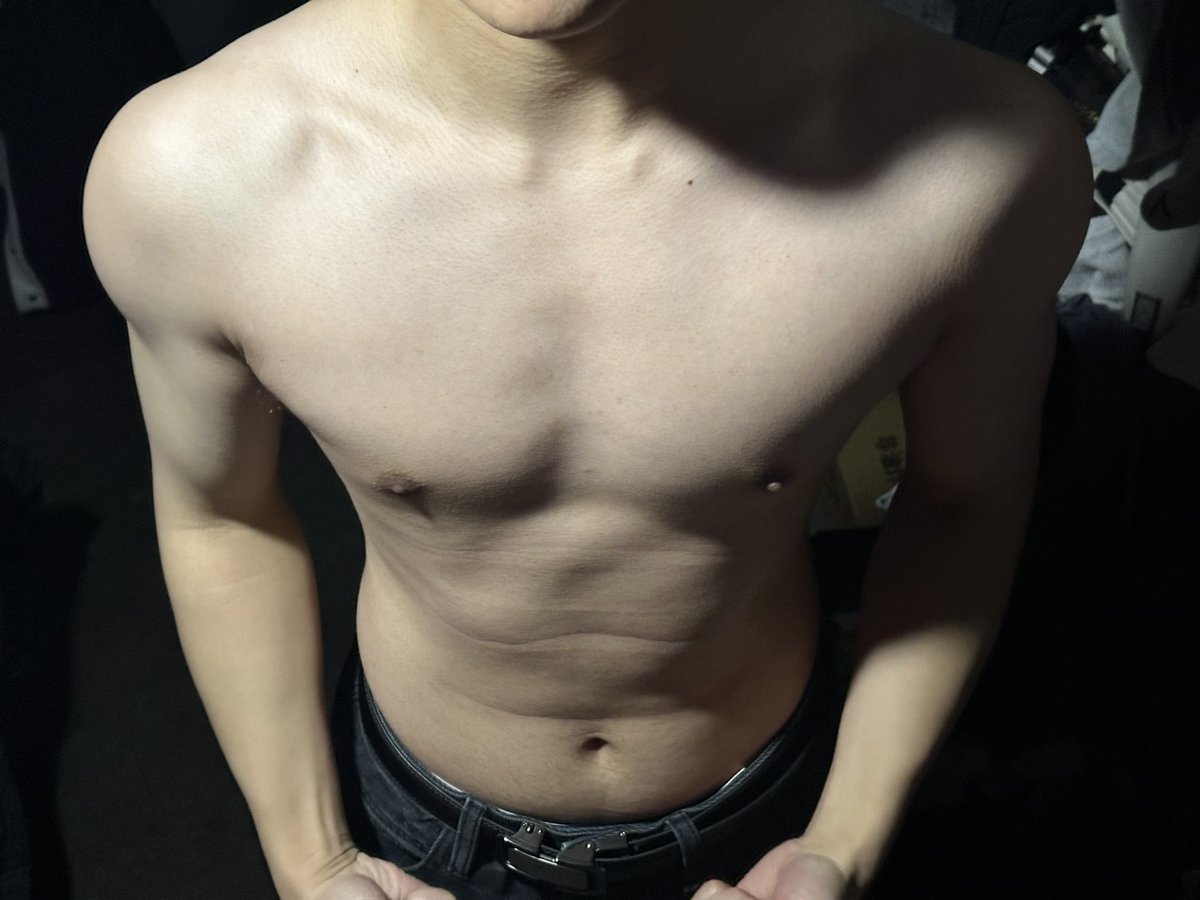 Kier998's tweet photo. 体质还是有点高😿 https://t.co/WnATVwxHQ5