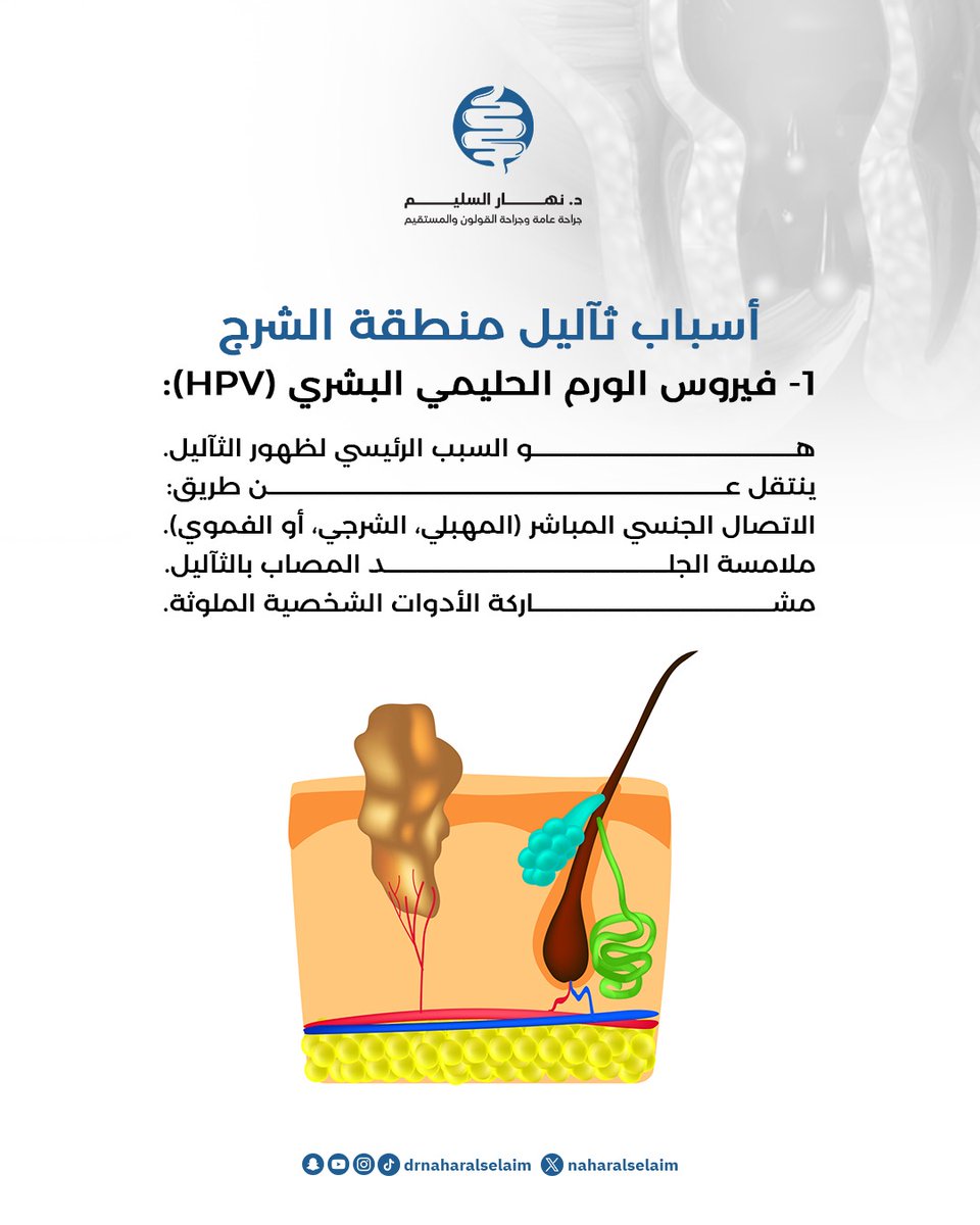 "أسباب ثآليل منطقة الشرج"

د.نهار السليم 
جراحة عامة وجراحة القولون والمستقيم 
للتنسيق والاستفسار: 0553983723
الموقع : مستشفى دلة النخيل- الرياض 

#الطب #الرياض #الشرج #جلدية #تناسلية #جراحة #جراحة_عامة #قولون #المستقيم