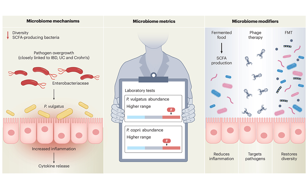 Nature Portfolio (@natureportfolio) on Twitter photo A Review in <a href="/NatureMedicine/">Nature Medicine</a> summarizes recent and compelling examples of microbiome-based interventions that are ripe for clinical adoption while also discussing the challenges and opportunities facing the field. go.nature.com/3Ec9RA6 🔒 A Review in <a href="/NatureMedicine/">Nature Medicine</a> summarizes recent and compelling examples of microbiome-based interventions that are ripe for clinical adoption while also discussing the challenges and opportunities facing the field. go.nature.com/3Ec9RA6 🔒