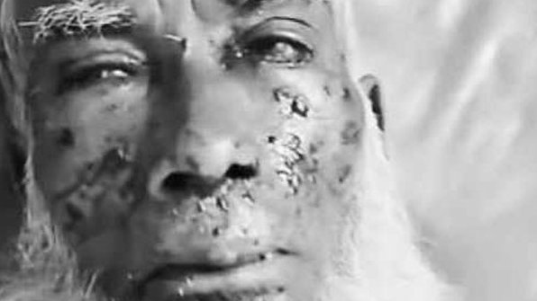 কৃষি জমিতে কাজ করার সময় বোমা বিস্ফোরণে কৃষক আহত