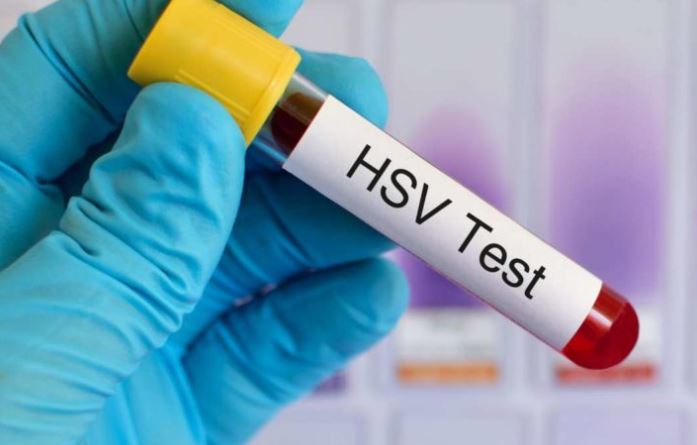 It's #STIAwarenessWeek!

CLINICIANS: How do you deliver an STI diagnosis to patients?  Can we do better?

Upcoming NNPTC training on the diagnosis and management of STI's: courses.nnptc.org/upcoming_class…

Patient Story of Herpes Diagnosis: healthywomen.org/real-women-rea…