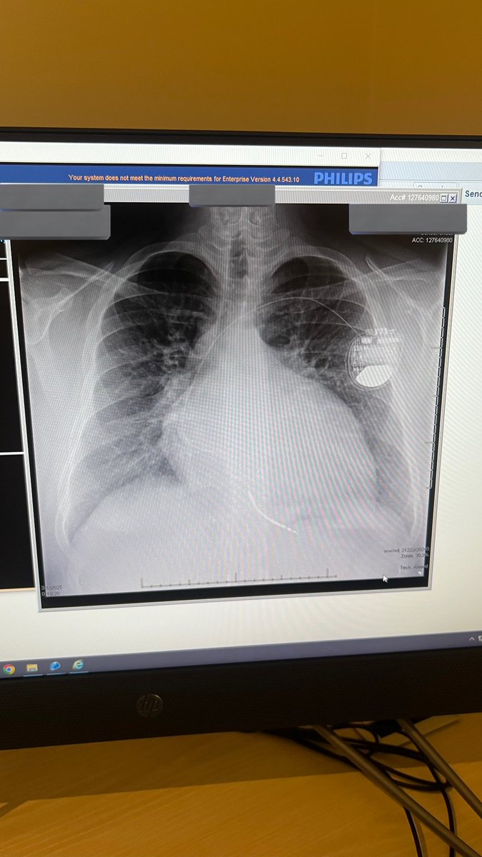 ونرجع لمود عشوائيات👀؟