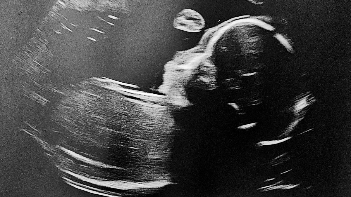 I have a ✨second baby✨ on the way‼️

With that being said…

Who wants to manage and run my TikTok? You can have 90-100% of the ad revenue and sponsorships 

I already spend most my day being a dad to the first baby that I only have time to stream.   HMU 🤙🏾