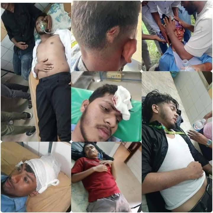 sohel_rpi's tweet image. শিক্ষার্থীদের উপর গাড়ি চালা
না হয় গুলি করবো📷
-সেনাবাহিনী
BD Army আপনাদের কাছেও এই কথা শুনতে পাই, দুঃখজনক 📷📷
#StopAttackingStudents
#JusticeForPolytechnicStudents
#sohel_rpi