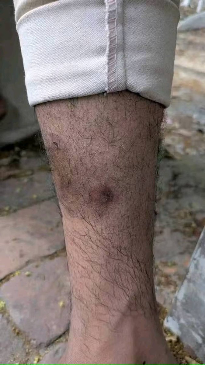 sohel_rpi's tweet image. শিক্ষার্থীদের উপর গাড়ি চালা
না হয় গুলি করবো📷
-সেনাবাহিনী
BD Army আপনাদের কাছেও এই কথা শুনতে পাই, দুঃখজনক 📷📷
#StopAttackingStudents
#JusticeForPolytechnicStudents
#sohel_rpi